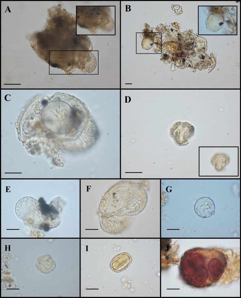 Tartaro dai denti di una comunità del neolitico-calcolitico: quali informazioni? immagine decorativa