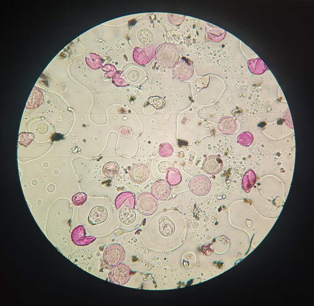 Allergie stagionali: gli effetti del cambiamento climatico sulla fioritura immagine decorativa